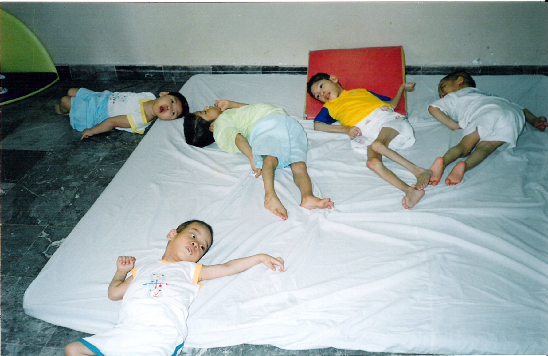 Agent Orange affected children